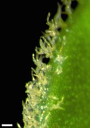 Veronica notialis. Leaf margin showing white tangled hairs and stomata on adaxial surface. Scale = 0.1 mm.
 Image: W.M. Malcolm © Te Papa CC-BY-NC 3.0 NZ